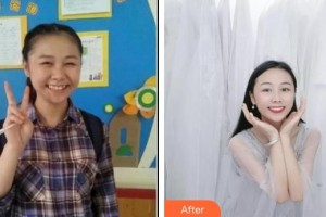 湖州陳景康牙科診所陳景康整形價格表附金屬托槽矯正案例展示