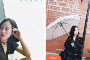 紹興德維口腔醫(yī)院劉勇整形價格表附牙貼面案例展示