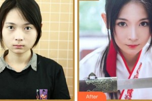 紹興愛爾眼科醫(yī)院閔宗英整形價格表附眼部綜合案例展示