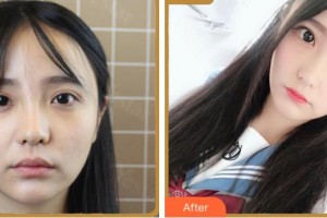 紹興愛爾眼科醫(yī)院田玉蘭整形價格表附眼部綜合案例展示