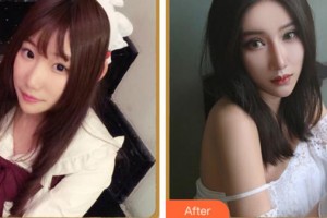 紹興愛爾眼科醫(yī)院王曉瑛整形價格表附眼部綜合案例展示