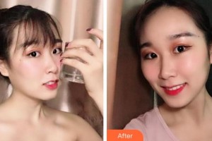 紹興越中口腔醫(yī)院傅仁林整形價格表附冷光美白案例展示