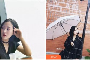 紹興市口腔醫(yī)院王曉玲整形價格表附牙貼面案例展示