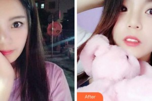 紹興京韓口腔醫(yī)院薛敏整形價格表附牙齒隱形矯正案例展示