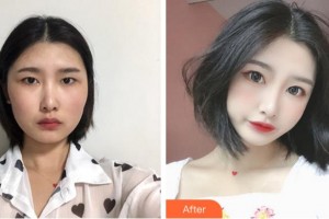 清遠華美整形外科門診部劉金華整形價格表附切開雙眼皮案例展示