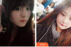 金華周亞軍口腔門(mén)診部張政通整形價(jià)格表附根管調(diào)節(jié)案例展示