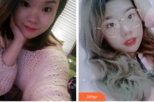 金華周亞軍口腔門(mén)診部袁云志整形價(jià)格表附牙齒隱形矯正案例展示