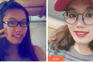 金華口腔醫(yī)院夏坤整形價(jià)格表附牙綜合案例展示