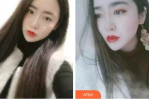 金華口腔醫(yī)院馬國(guó)強(qiáng)整形價(jià)格表附金屬托槽矯正案例展示