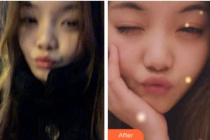 金華口腔醫(yī)院施心暢整形價(jià)格表附牙齒隱形矯正案例展示