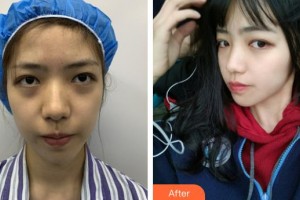 舟山沈虹醫(yī)療美容診所陸勝利整形價(jià)格表附埋線提升案例展示