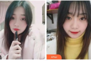 臺州拜博口腔醫(yī)院王學(xué)俠整形價格表附牙齒隱形矯正案例展示