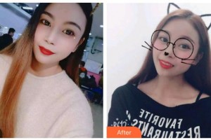 臺州康貝佳口腔醫(yī)院趙承煥整形價格表附牙貼面案例展示