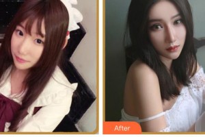 臺(tái)州國際眼科醫(yī)院黃春聯(lián)整形價(jià)格表附眼部綜合案例展示