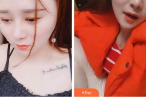 臺州康貝佳口腔醫(yī)院余新統(tǒng)整形價格表附超聲波潔牙案例展示