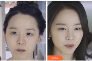 四川西嬋整形美容醫(yī)院黃琪平醫(yī)務(wù)科科長整形價格表附激光除皺案例展示