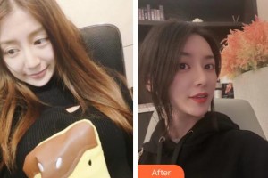 四川圣麗整形美容醫(yī)院李理整形價(jià)格表附鼻修復(fù)案例展示