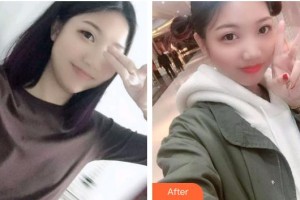 自貢維樂新橋口腔門診部田玉霞整形價(jià)格表附根管調(diào)節(jié)案例展示