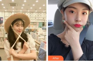 攀枝花市中心醫(yī)院燒傷整形美容科劉大海整形價(jià)格表附熱拉提案例展示