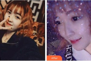 德陽(yáng)維樂新橋口腔門診部孫玉楓整形價(jià)格表附超聲波潔牙案例展示