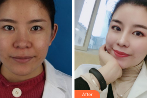 深圳新興皮膚病專科門診部周秋根整形價格表附皮膚管理案例展示