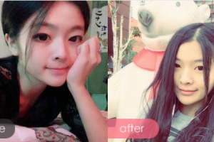 深圳黛顏醫(yī)療美容醫(yī)院馬蘭整形價格表附女性私密案例展示