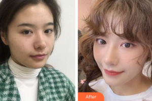 深圳圣雅門診部醫(yī)療美容科萬蕓整形價格表附抗衰老案例展示