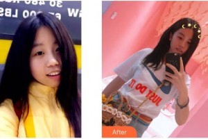 遂寧嘉慧口腔門診部蒲成浩整形價格表附超聲波潔牙案例展示