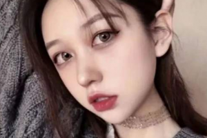 濱州滬濱愛爾眼科醫(yī)院黃欣整形價格表附切開雙眼皮案例展示