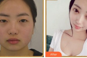 內(nèi)江韓美醫(yī)療美容門(mén)診部趙君海整形價(jià)格表附眼部綜合案例展示