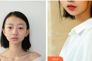 樂(lè)山金手指醫(yī)學(xué)美容診所岑曉勇整形價(jià)格表附鼻部綜合案例展示