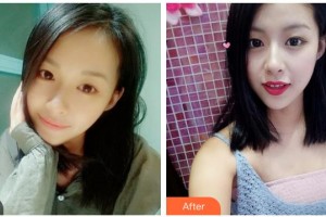 樂(lè)山王玉琨皮膚病?？漆t(yī)院張麗整形價(jià)格表附眼部綜合案例展示