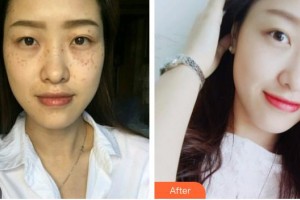 南充嬌美傾城醫(yī)學(xué)美容門診部劉曉春整形價(jià)格表附鐳射凈膚案例展示