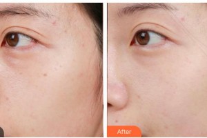 南充嬌美傾城醫(yī)學(xué)美容門診部王健整形價(jià)格表附激光美膚激光案例展示