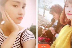 南充華醫(yī)口腔醫(yī)院劉科伽整形價(jià)格表附美白劑美白牙齒案例展示