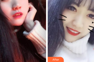 深圳南州口腔門診部吳鎮(zhèn)波整形價(jià)格表附牙齒美白案例展示