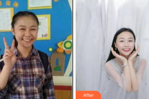 深圳德道口腔門診部李加亮整形價格表附牙齒矯正案例展示