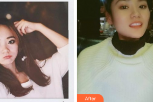 深圳童美口腔門診部田云整形價(jià)格表附瓷貼面案例展示