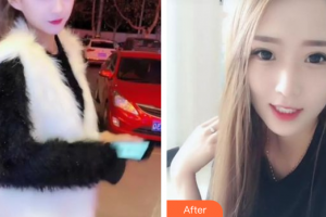 深圳羅湖區(qū)同步口腔門診部王娜整形價(jià)格表附牙齒隱形矯正案例展示