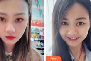 深圳德貝美口腔門診部焦偉波整形價(jià)格表附牙齒隱形矯正案例展示