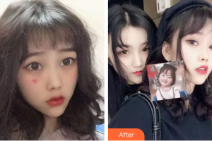 深圳正夫口腔門診部嚴(yán)寧整形價(jià)格表附牙齒隱形矯正案例展示