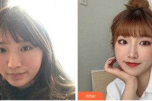 宜賓市第一人民醫(yī)院整形燒傷科張攀整形價格表附激光祛斑案例展示