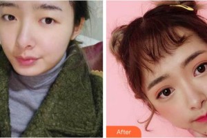 宜賓曼薇醫(yī)學(xué)整形醫(yī)院鄭祥兵整形價格表附眼部綜合案例展示