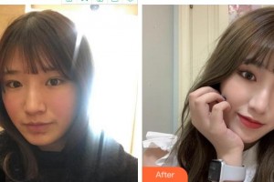 宜賓華膚皮膚病醫(yī)院顧昌林整形價(jià)格表附光子嫩膚案例展示