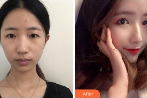 宜賓天使之翼醫(yī)療美容整形門(mén)診部尤軍整形價(jià)格表附眼部綜合案例展示