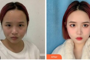 達(dá)州海博醫(yī)學(xué)美容醫(yī)院歐海云整形價(jià)格表附激光祛斑案例展示