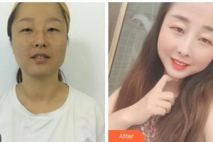 達(dá)州喬妍醫(yī)療美容診所尹秀山整形價(jià)格表附白瓷娃娃案例展示