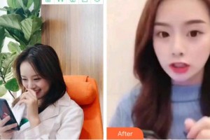 達(dá)州華美口腔醫(yī)院張雪霏整形價(jià)格表附牙齒隱形矯正案例展示