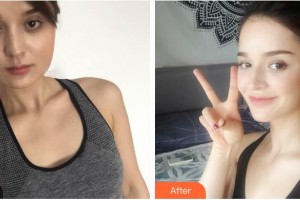 武警湖南總隊醫(yī)院整形美容中心孔偉立整形價格表附激光美膚激光案例展示