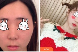 湖南省第二人民醫(yī)院整形美容中心倪若鳴整形價(jià)格表附光子嫩膚案例展示